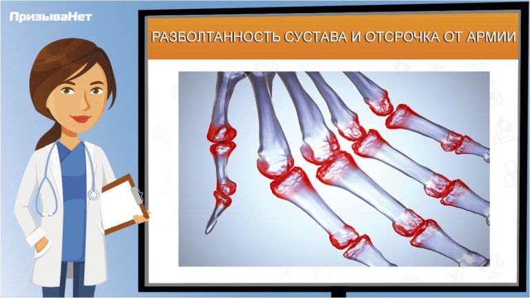 Нестабильность сустава и отсрочка от армии