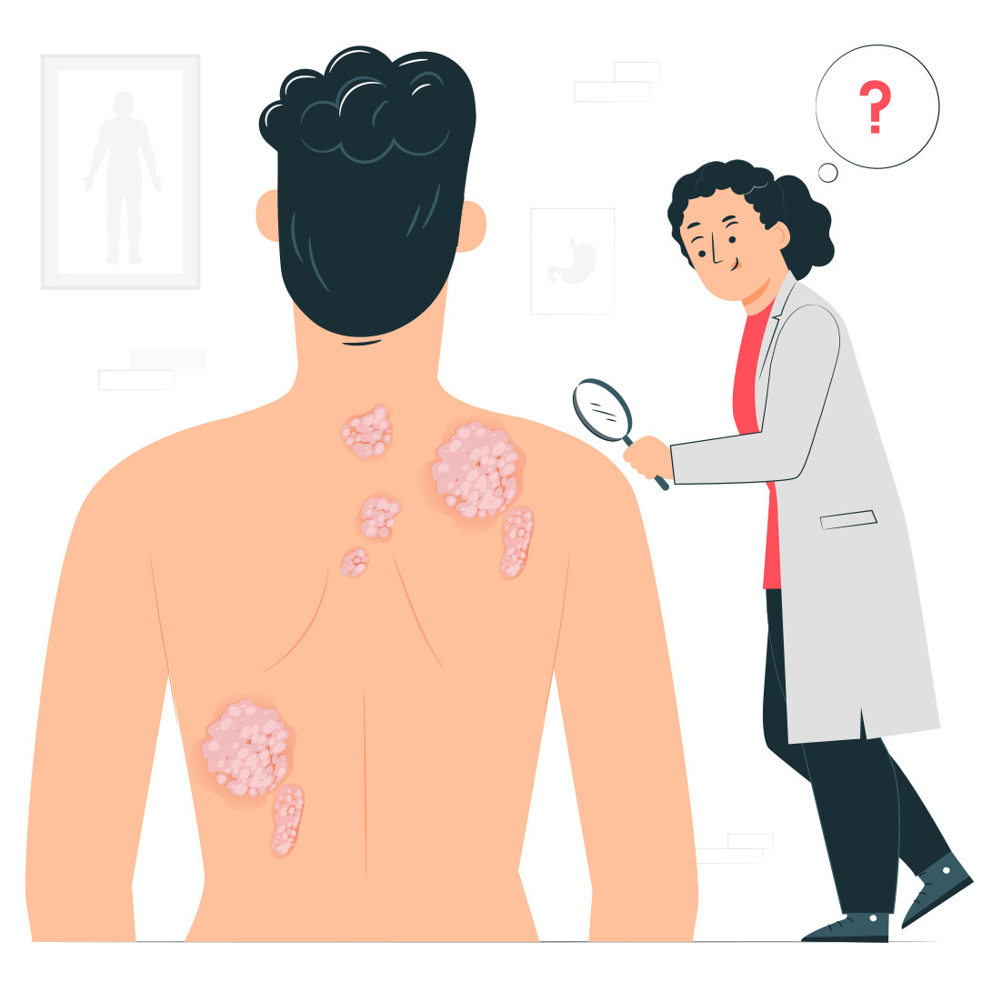 Армия при травмах кожи и подкожной клетчатки