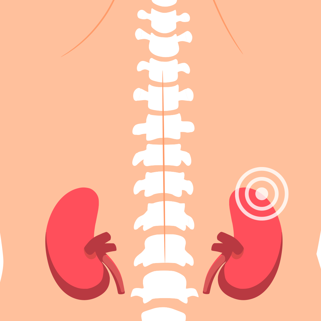 Берут ли в армию с амилоидозом почек?