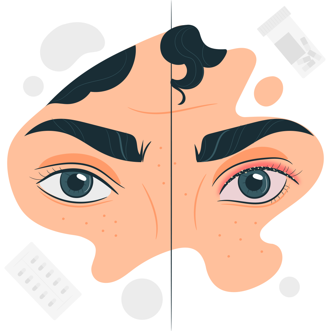 Блефарит и армия