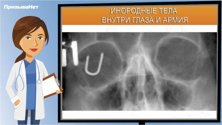 Инородные тела внутри глаза и армия