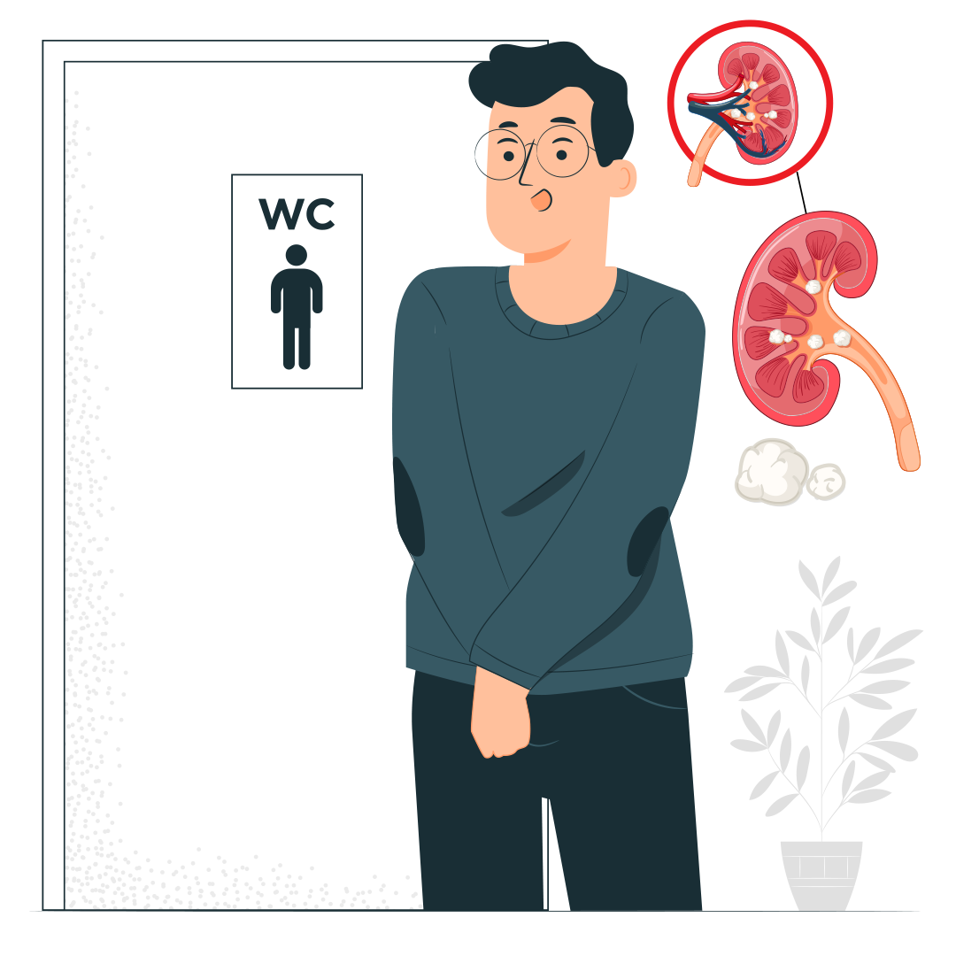 Камни в почках и армия