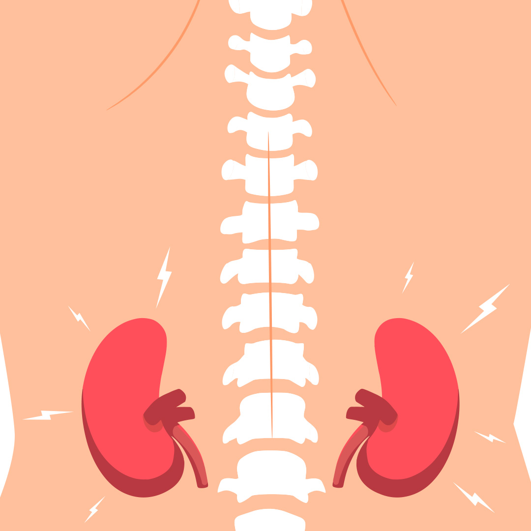 Нефротический синдром и армия