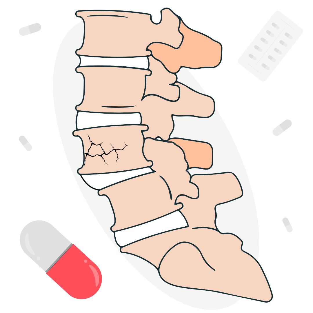 Последствия перелома дужек