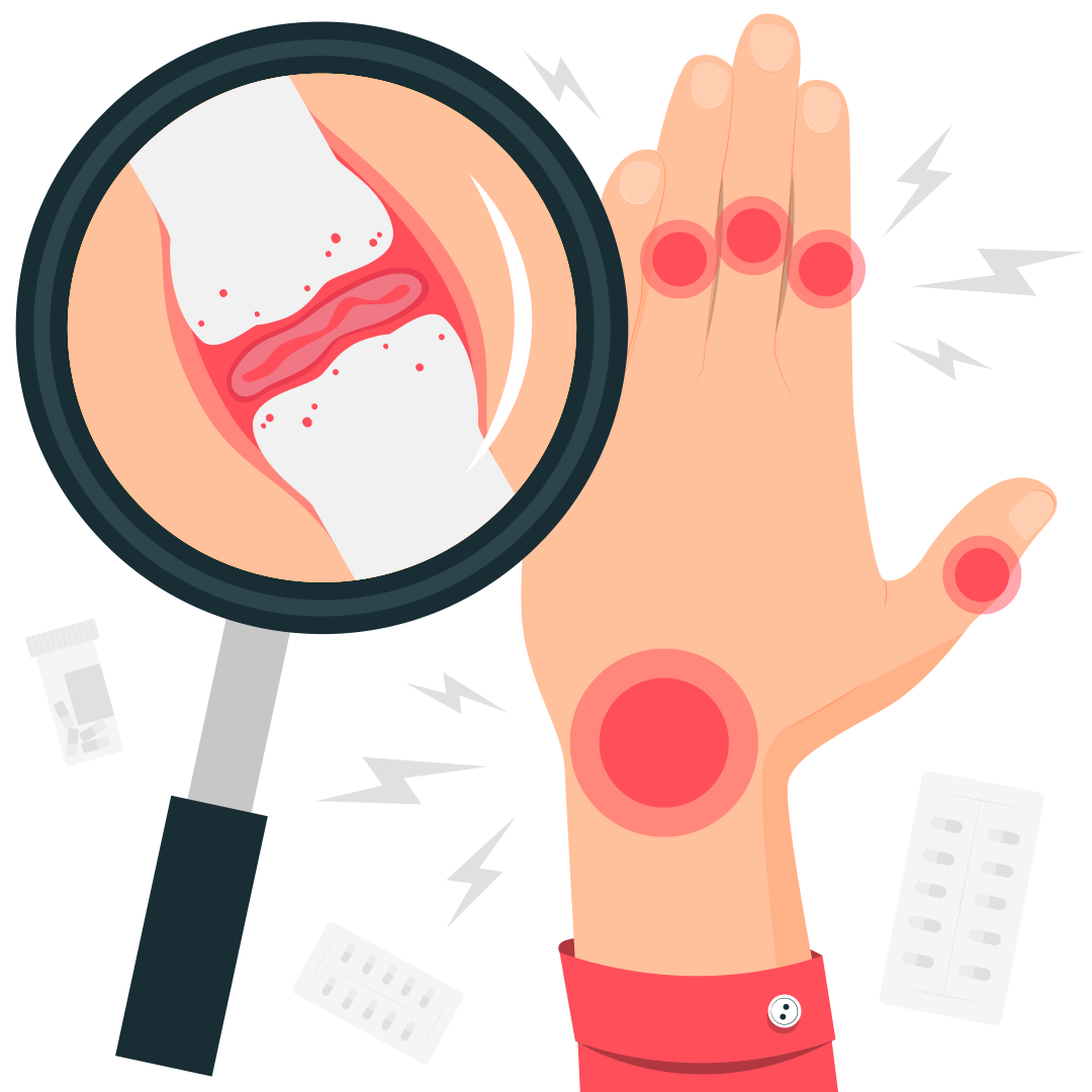 Ревматизм и армия