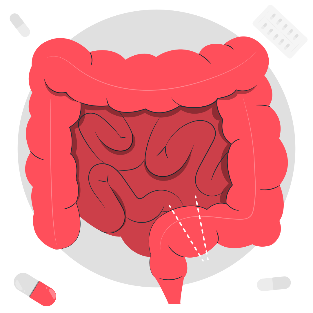 Резекция толстой кишки и отсрочка от армии