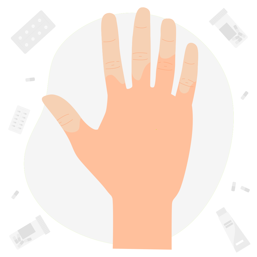 Годность к службе в армии с синдромом Рейно