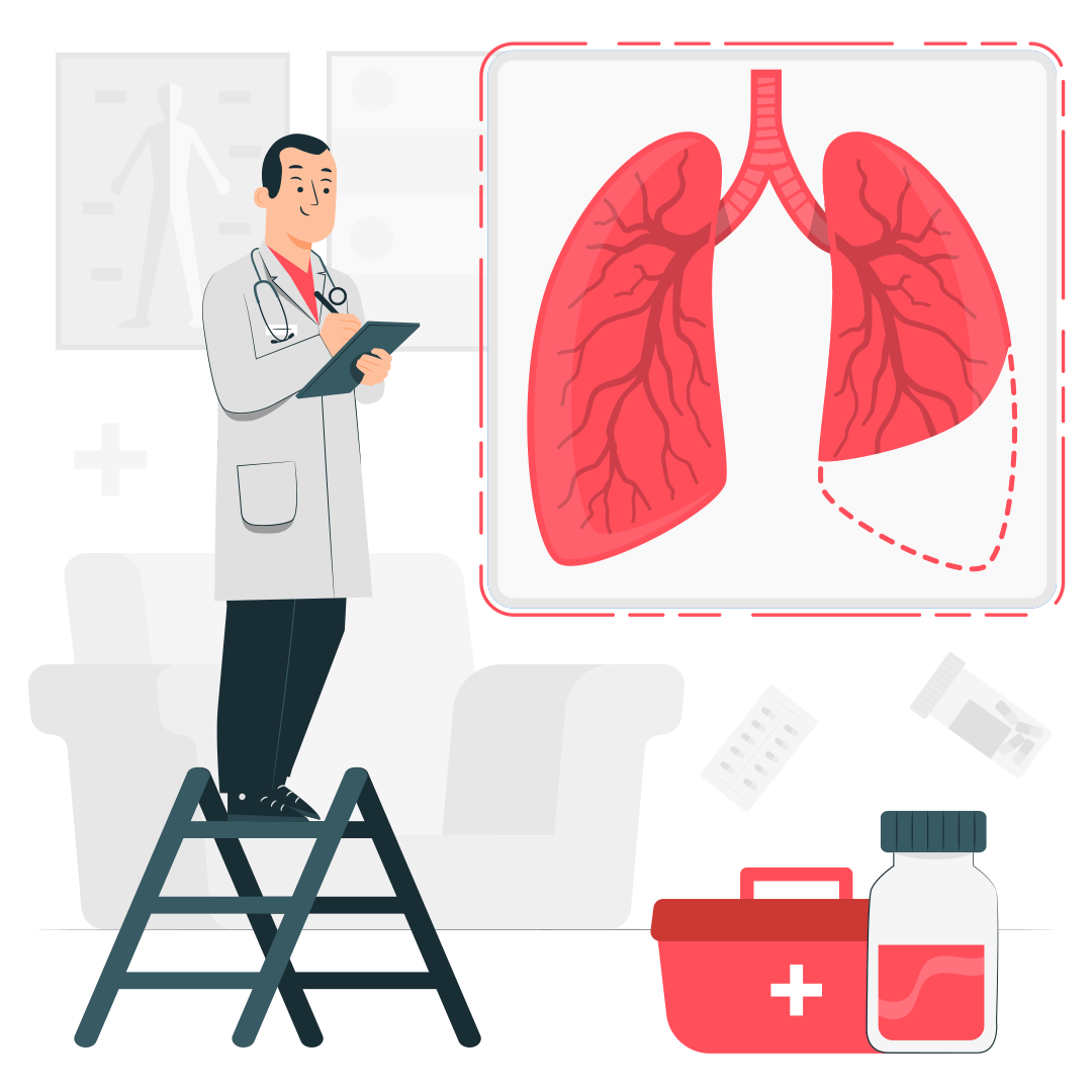 Удаление доли легкого и армия