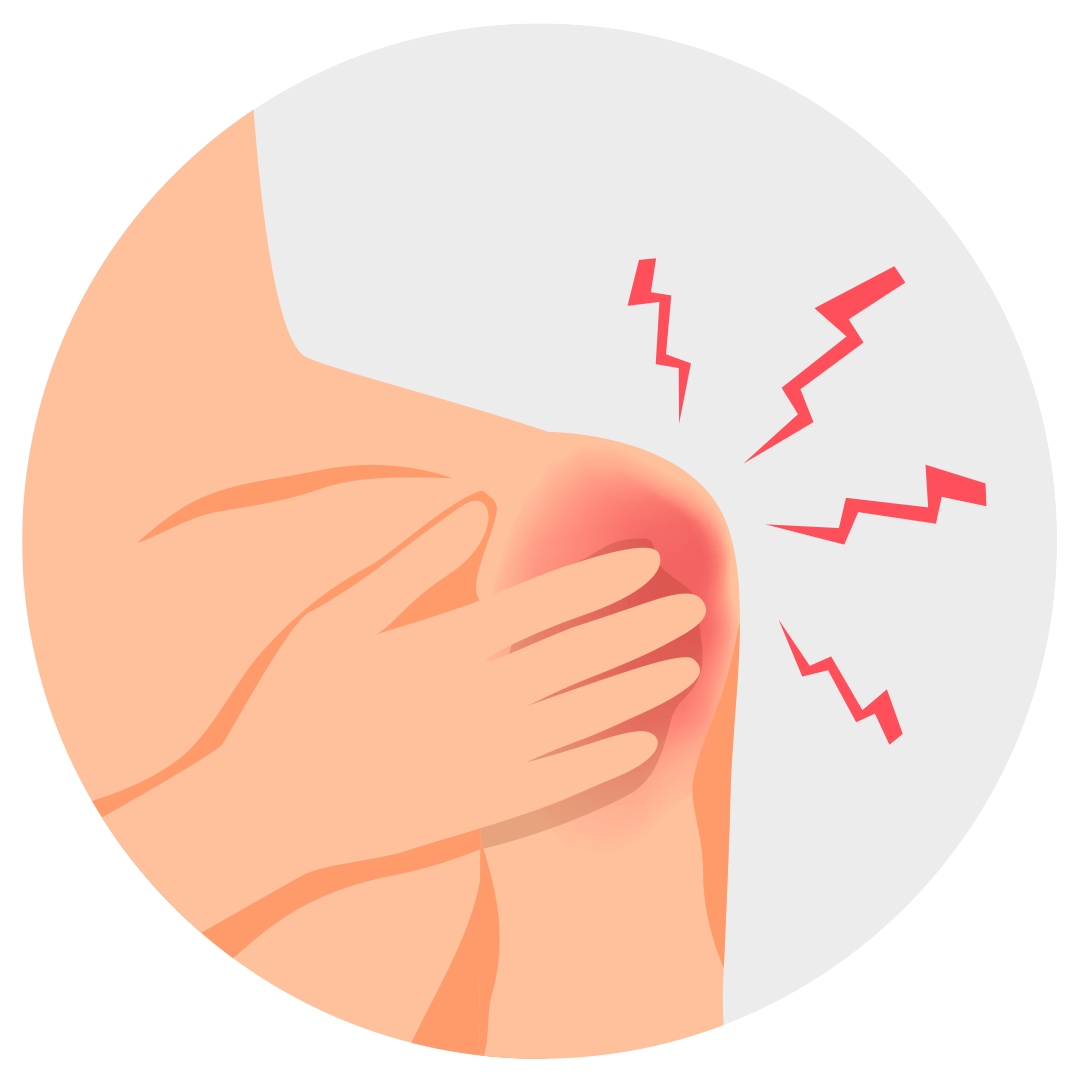 Вывихи плечевого сустава и отсрочка от армии